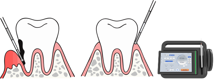 Treatment illustration