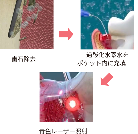 治療の様子