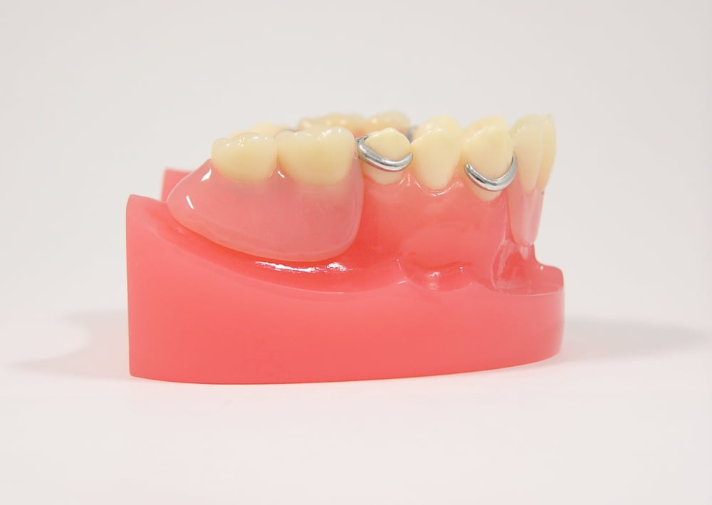 入れ歯・義歯との比較