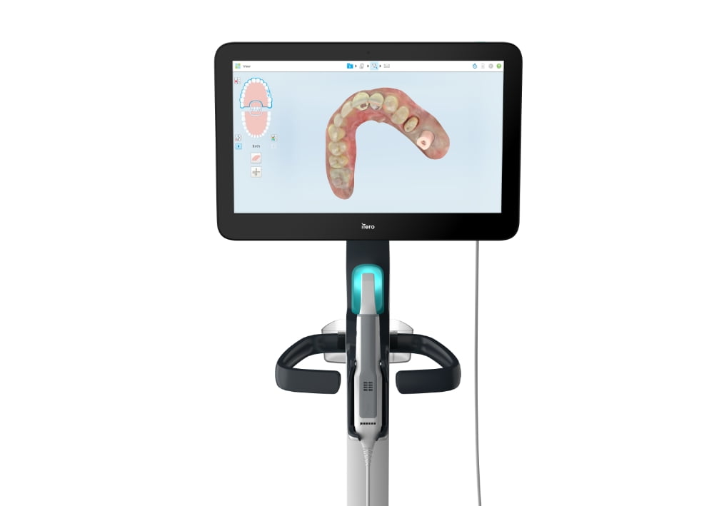 iTeroで快適・正確な矯正治療