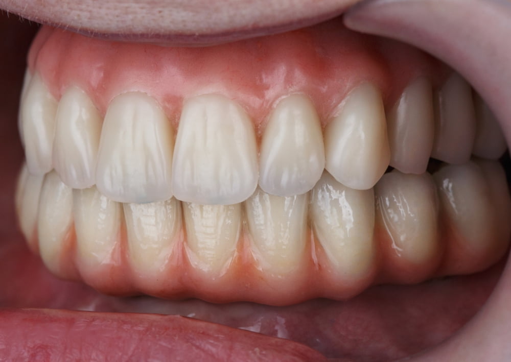 歯周病を早期発見できる